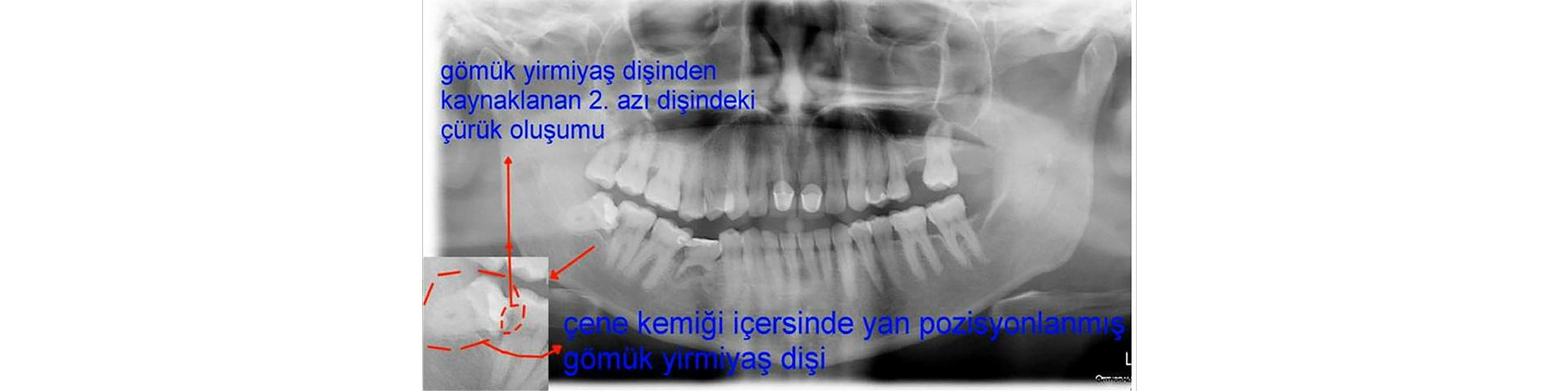 cerrahi tedaviler